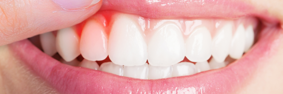 又上火又怕冷？上熱下寒、水火不濟，教你調(diào)回來！