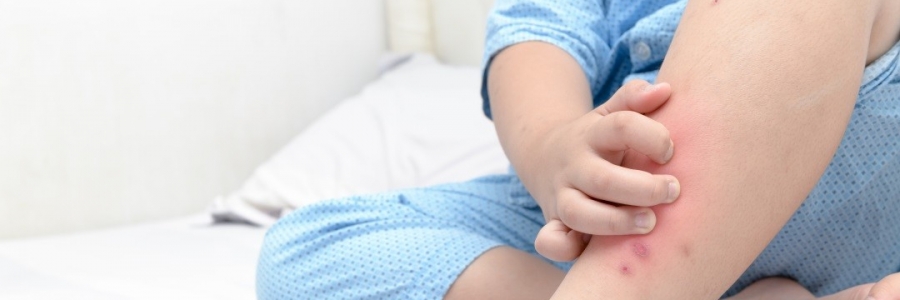 學(xué)古人這樣驅(qū)蚊，從此不再“蚊”風(fēng)喪膽！