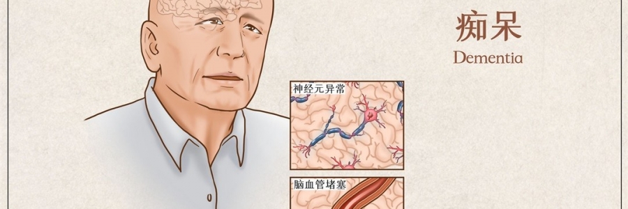 “馬什么梅？”年紀輕輕老忘事，竟是癡呆的前兆？！