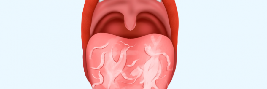 舌苔辨識“九種中醫(yī)體質”（配圖）