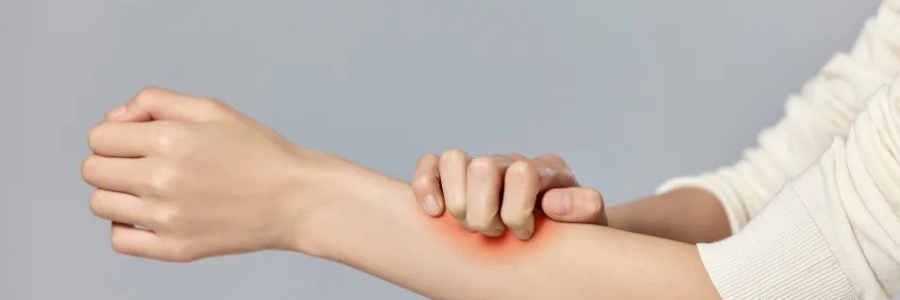 濕疹、瘙癢、蕁麻疹……患皮膚病，也許是好事！