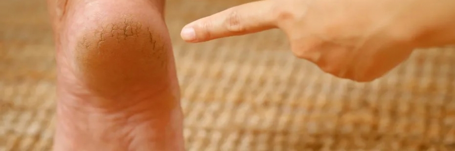 每天跺跺腳，從腳養(yǎng)到頭，越跺越年輕！